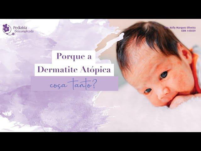 DERMATITE ATÓPICA: DÚVIDAS SOBRE A PELE | PEDIATRIA DESCOMPLICADA COM DRA. KELLY OLIVEIRA