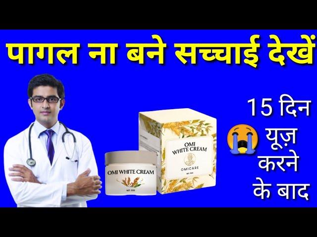 OMI White Cream Honest Review|OMI White Cream Side Effects|OMI White Cream 2024|OMI White Cream Uses