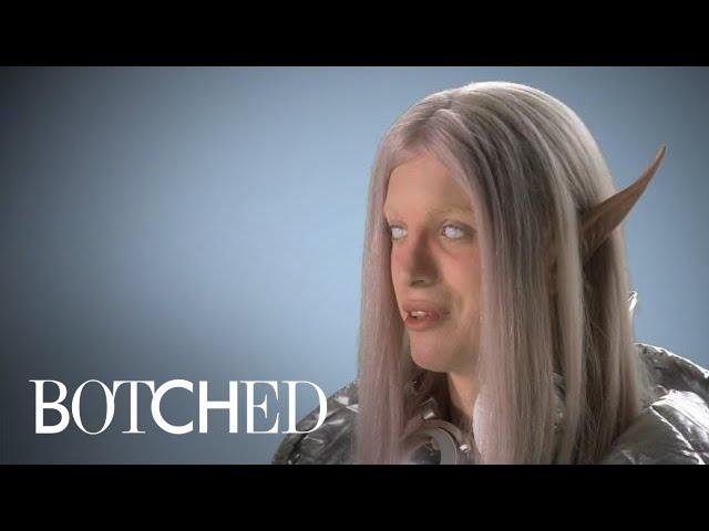 "Botched" Patient Wants to Be the Perfect Space Elf | E!