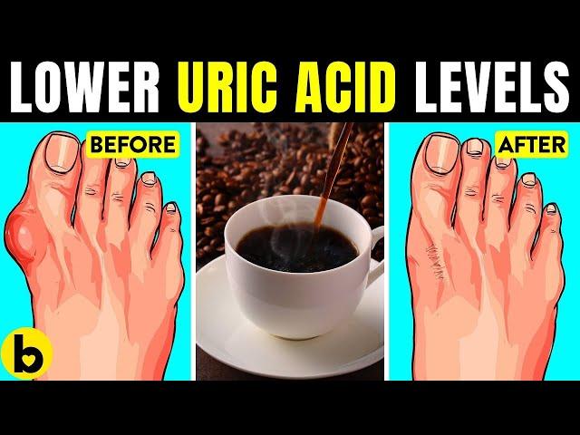 Lower Your Uric Acid Levels Naturally With These 10 Effective Methods