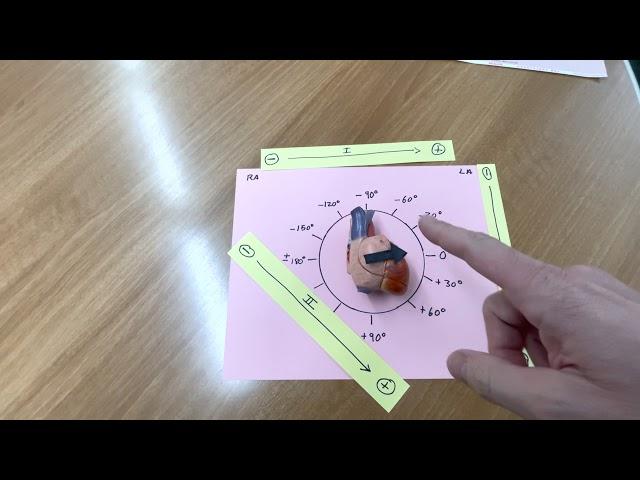 Cardiac Axis Determination