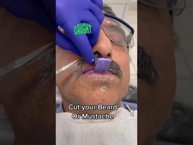 When you make a mess during dental impression#video #TikTok#trending #viral #youtubeshorts #shorts