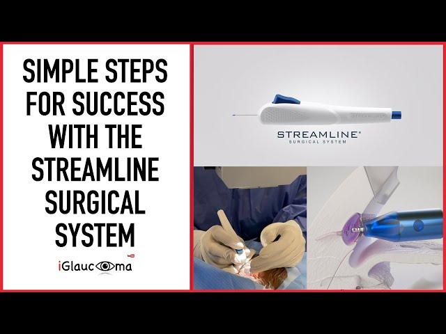 Streamline Surgical System - Simple Steps for MIGS Success in Glaucoma Surgery