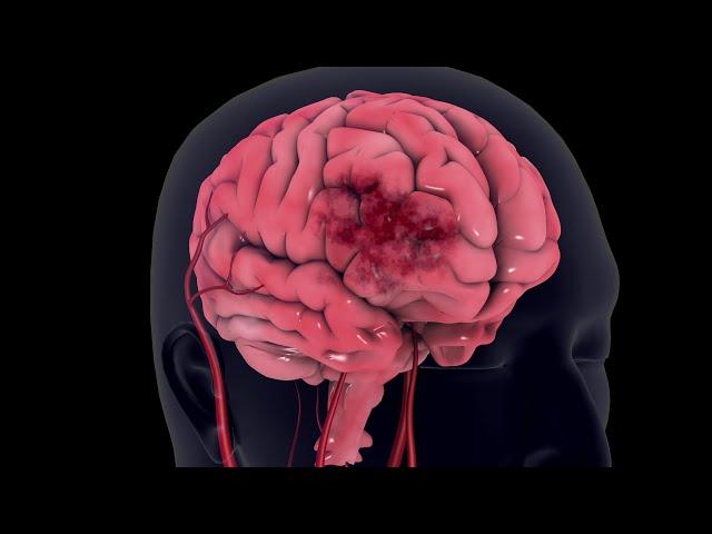 Stroke - 3d animation