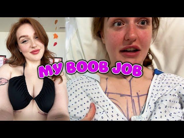 My Boob Job Vlog - Surgery, Recovery & Results!