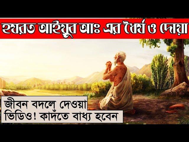 হজরত আইয়ুব নবীর স্রেষ্ঠ দোয়া ও ফেরেশতার আগমন। আজকেই শিখুন। ধৈর্য ও জীবন পাল্টে দেওয়া ঘটনা!