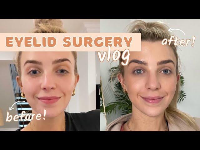 I HAD EYELID SURGERY/ Raw and real/ Weekly VLOG + Recover with me!