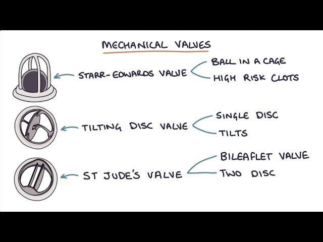 Prosthetic Heart Valves: Visual Explanation for Students