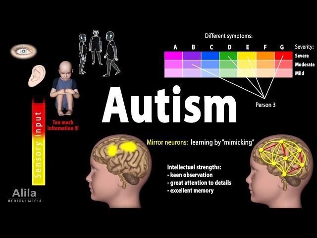 Autism Spectrum, Animation