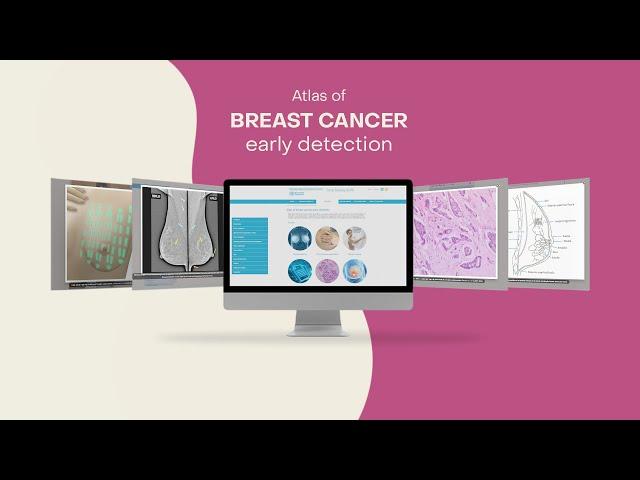 The Atlas of Breast Cancer Early Detection with Dr Susan Cherian