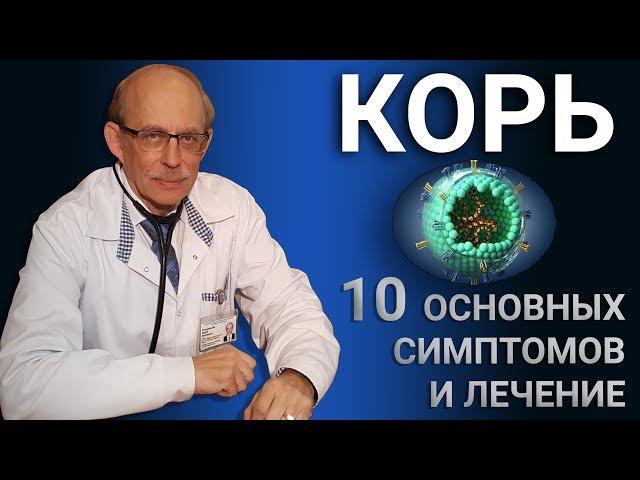 Корь у детей - 10 основных симптомов, как начинается и передается корь,  лечение и профилактика кори