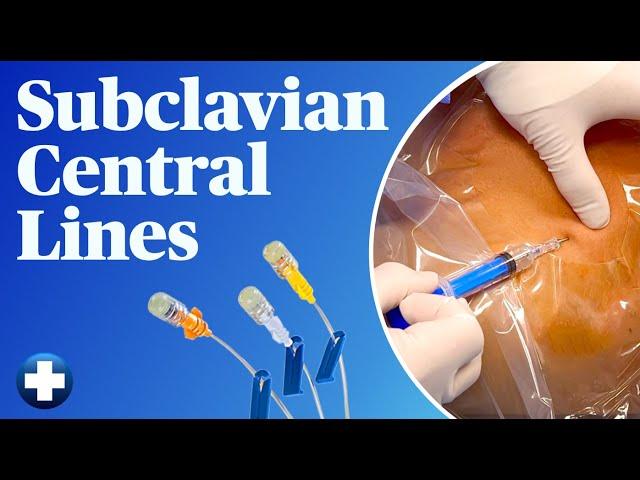 Subclavian Central Lines (Easy and Safe Landmark Method!)