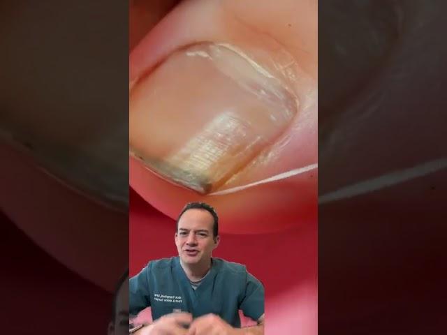 DOCTOR REACTS: FLOSSING YOUR TOENAILS?!