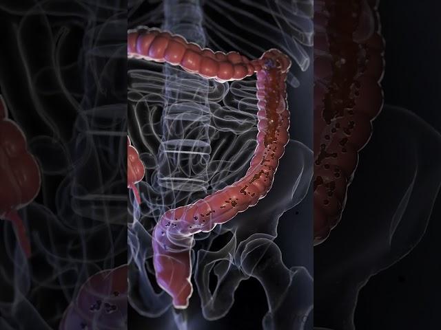 Understanding Diarrhea: Causes, Symptoms, and Management  #anatomy #meded #3danimation