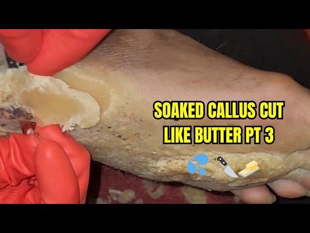 SOAKED CALLUS CUT LIKE BUTTER!! PT 3