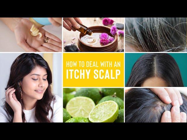 Itchy Scalp Treatments | Remedies For Dandruff, Lice and Scalp Acne