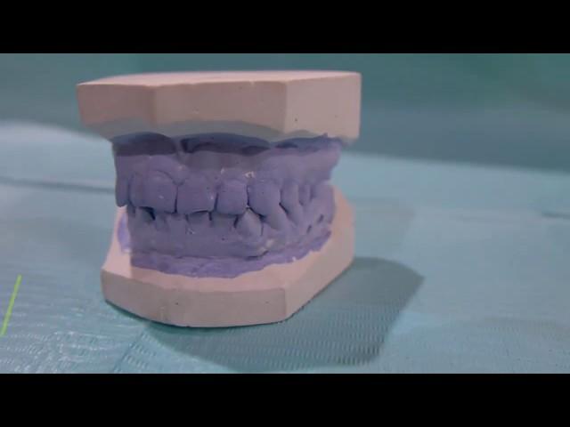 Tahapan sebelum pemasangan orthodontik - Damessa Klinik