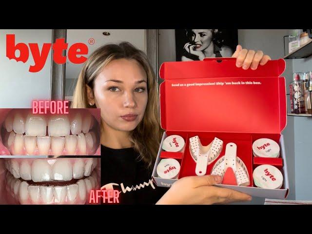 Byte Aligners Journey | How Much Did They Cost? Are They Worth It?