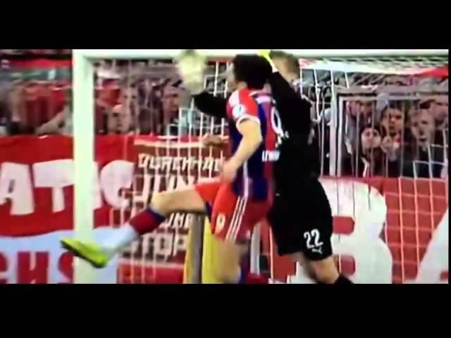 Robert Lewandowski injury broken jaw and Bayern Dortmund 28 4 2015