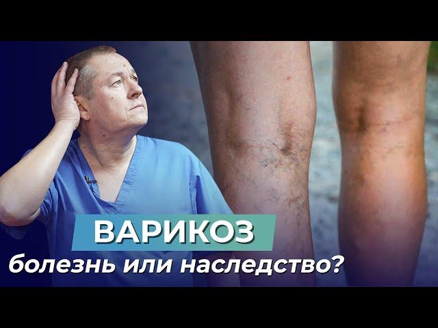 ВАРИКОЗ - НЕ ПРИГОВОР! Упражнение, которое ПОМОЖЕТ ВЫЛЕЧИТЬ варикозное расширение вен!