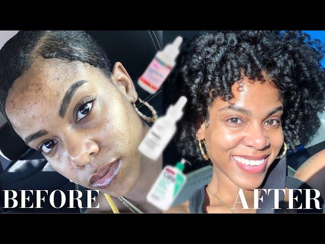 SKIN CARE UNDER $15! | HOW I'VE KEPT MY SKIN CLEAR | QUIESHA JAY