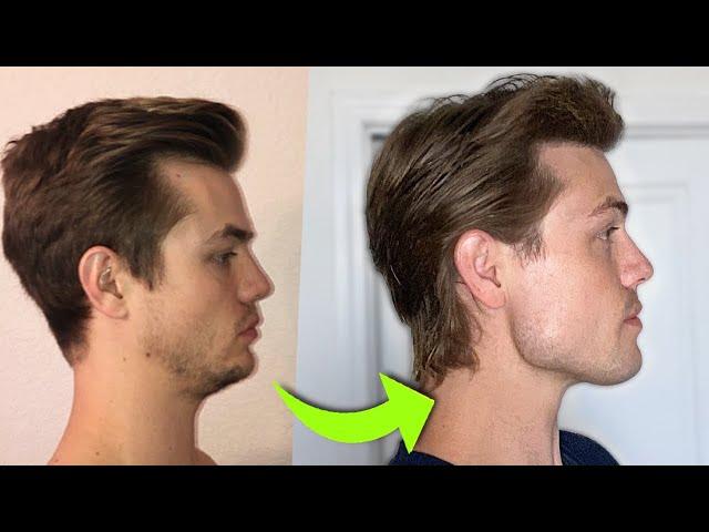 How I Fixed My Side Profile