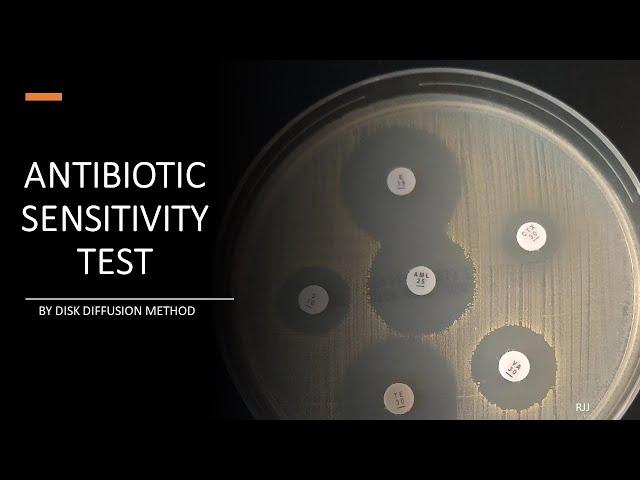 Antibiotic Sensitivity Test by Disc diffusion method (Kirby Bauer method & Stokes method)