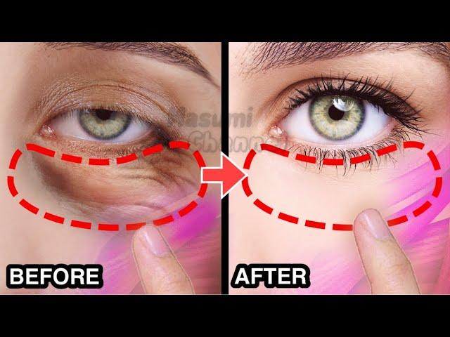 8MIN BEST EYE LIFTING EXERCISE FOR EYE BAGS, DARK CIRCLES UNDER EYES