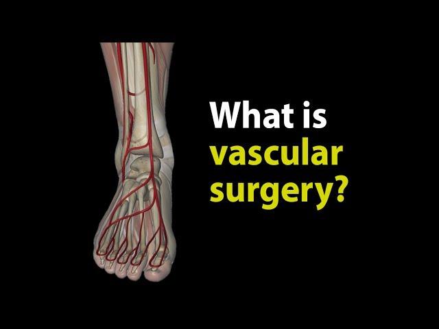 What is vascular surgery?