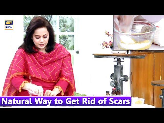 Natural Way to Get Rid of Scars - Dr Batool