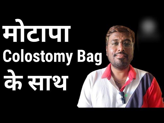 Colostomy bag के साथ क्या वजन बढ़ाना सही है | Weight gain after Ostomy surgery | Jaichand Rajasthani