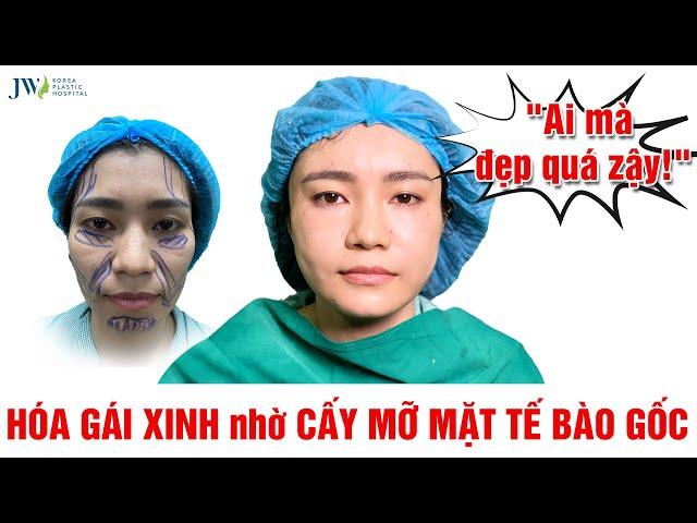 Chị gái CƯỜI TỦM TỈM vì TRẺ DỮ THẦN sau Cải lão gương mặt 3M Cấy mỡ mặt Tế bào gốc Multi+ tại JW