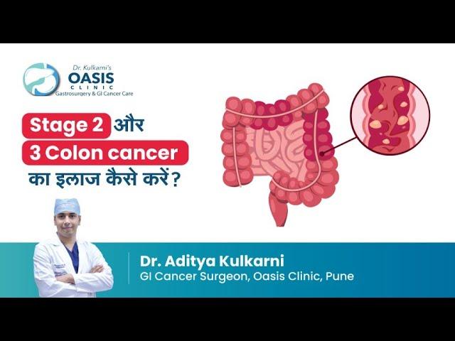 Stage 2 और 3 colon cancer का इलाज कैसे करें? | Dr Aditya Kulkarni | Oasis Clinic