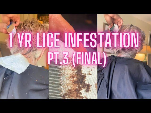 1 yr Lice Infestation Pt. 3 l Head Lice For Years l Lice Removal Service @staceythelouselady