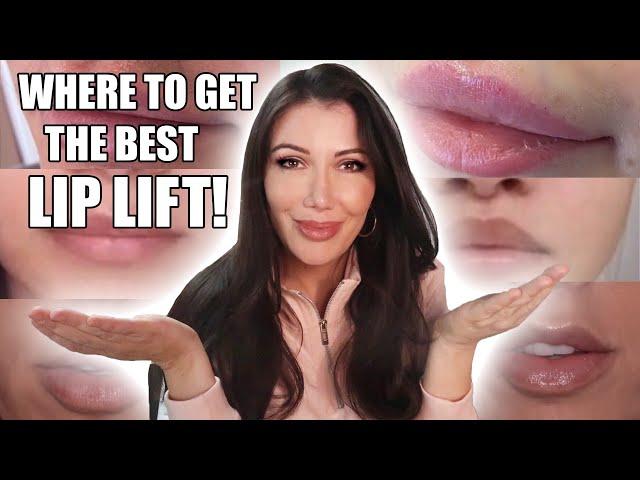 How to Find a Lip Lift Doctor