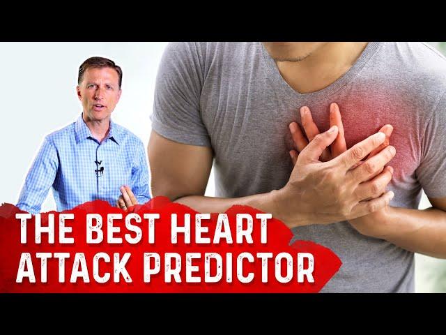 The Best Heart Attack Predictor – Coronary Artery Calcium (CAC) Score – Dr. Berg