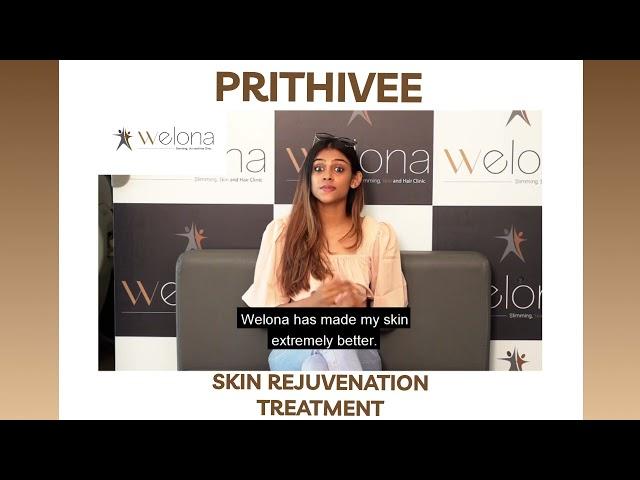 Skincare Q&A with model Prithivee and her experience with welona | Skin Rejuvenation Treatment