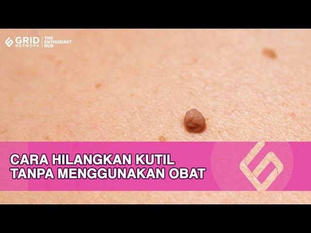 Ampuh! Cara Hilangkan Kutil Dengan Bawang Putih Agar Tak Tumbuh Lagi