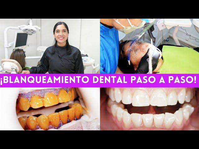 ¡ASÍ SE HACE UN BLANQUEAMIENTO DENTAL! | TE MUESTRO EL PASO A PASO  #blanqueamientodental