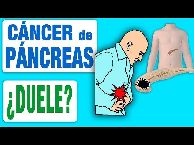 El cáncer de páncreas ¿duele?