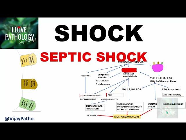 SHOCK: Types, Pathogenesis of Septic Shock