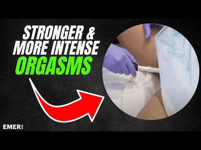 STRONGER, BETTER ORGASMS | VAGINAL REJUVENATION WITH FORMA V | Dr. Jason Emer