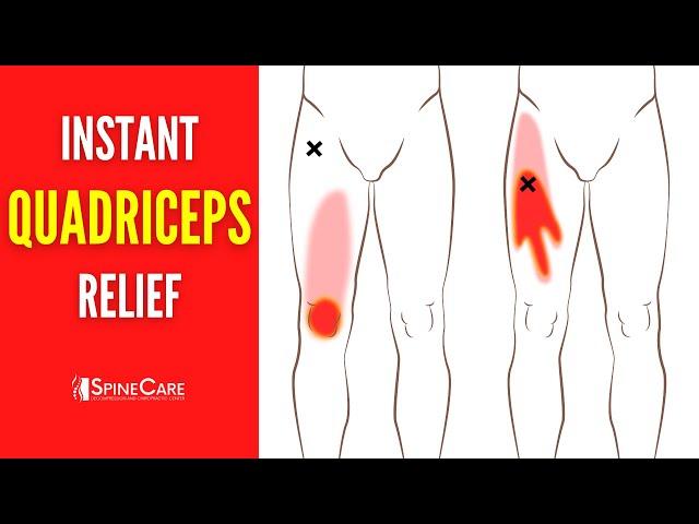 How to Fix Quadriceps Pain FOR GOOD