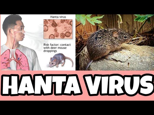 Hantavirus Cause, Sign and Symptoms, Precaution | Hantavirus Pulmonary Syndrome