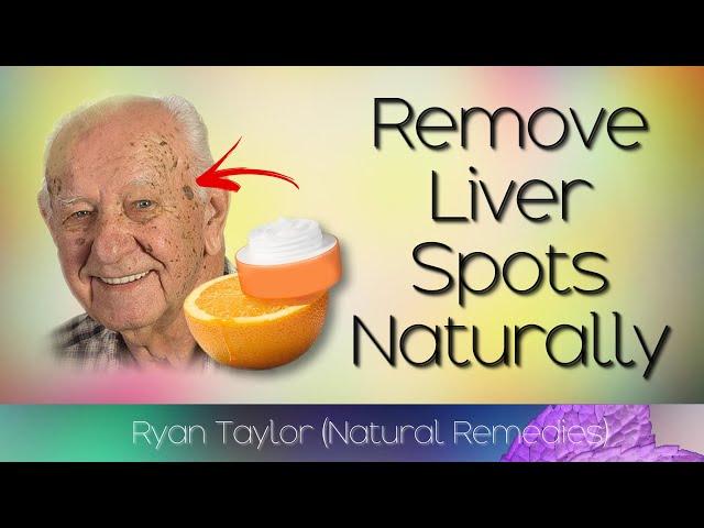 Remove Liver Spots Naturally (Age Spots Natural Remedies)