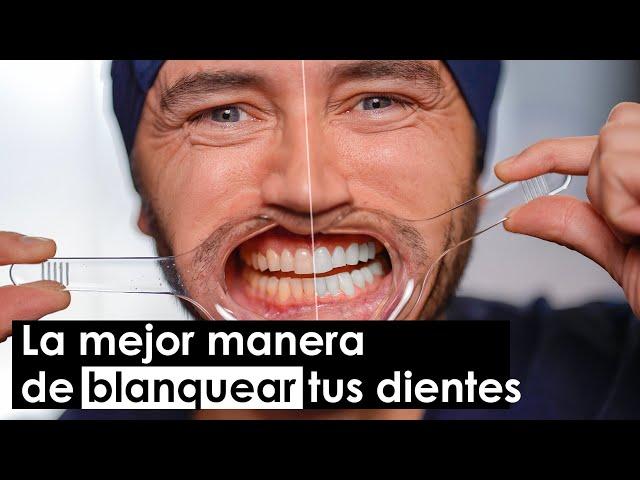 La mejor manera de blanquear los dientes