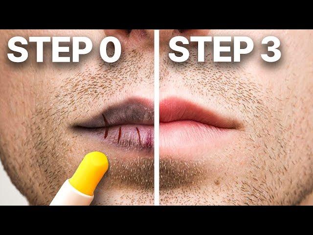 How To Treat Chapped Lips in 3 Easy Steps (Dermatologist)