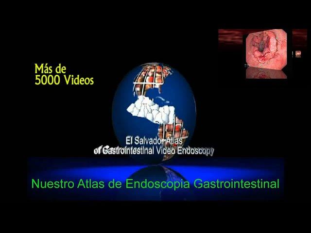 Nuestro Atlas de Endoscopia en Línea cumple 20 años