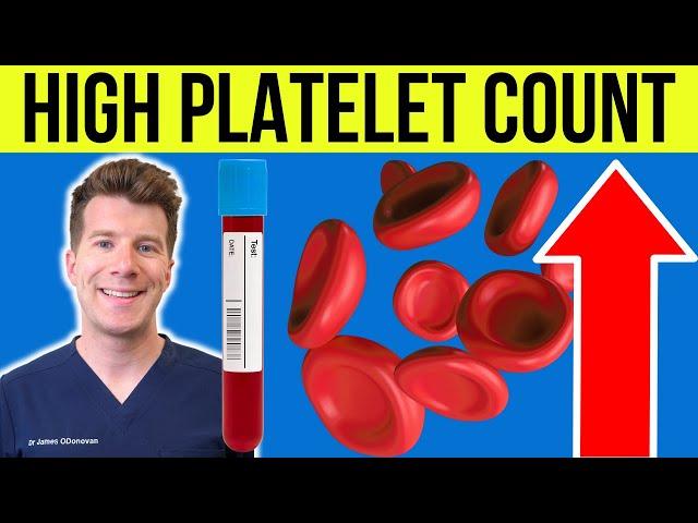 Doctor explains HIGH PLATELET COUNT (Thrombocytosis) | Causes, symptoms and more