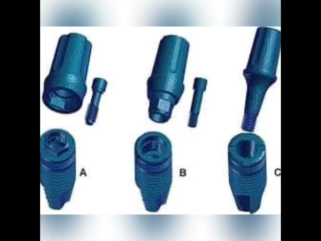 les differents  types d implant conexxions  et acastillages prothétiques